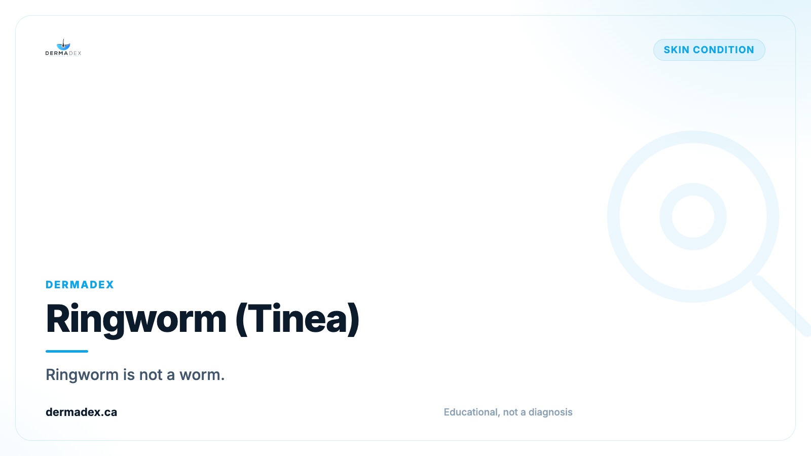 Ringworm (Tinea): How to Identify and Treat Fungal Skin Infections